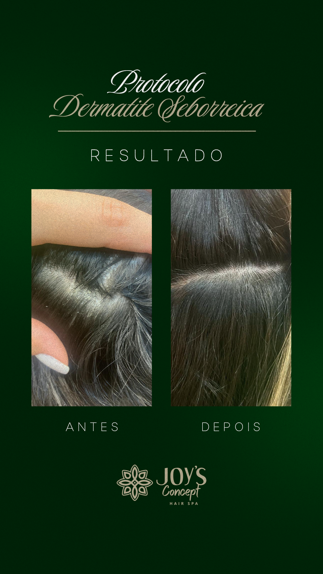 0402---Antes-X-Depois-1-dermatite