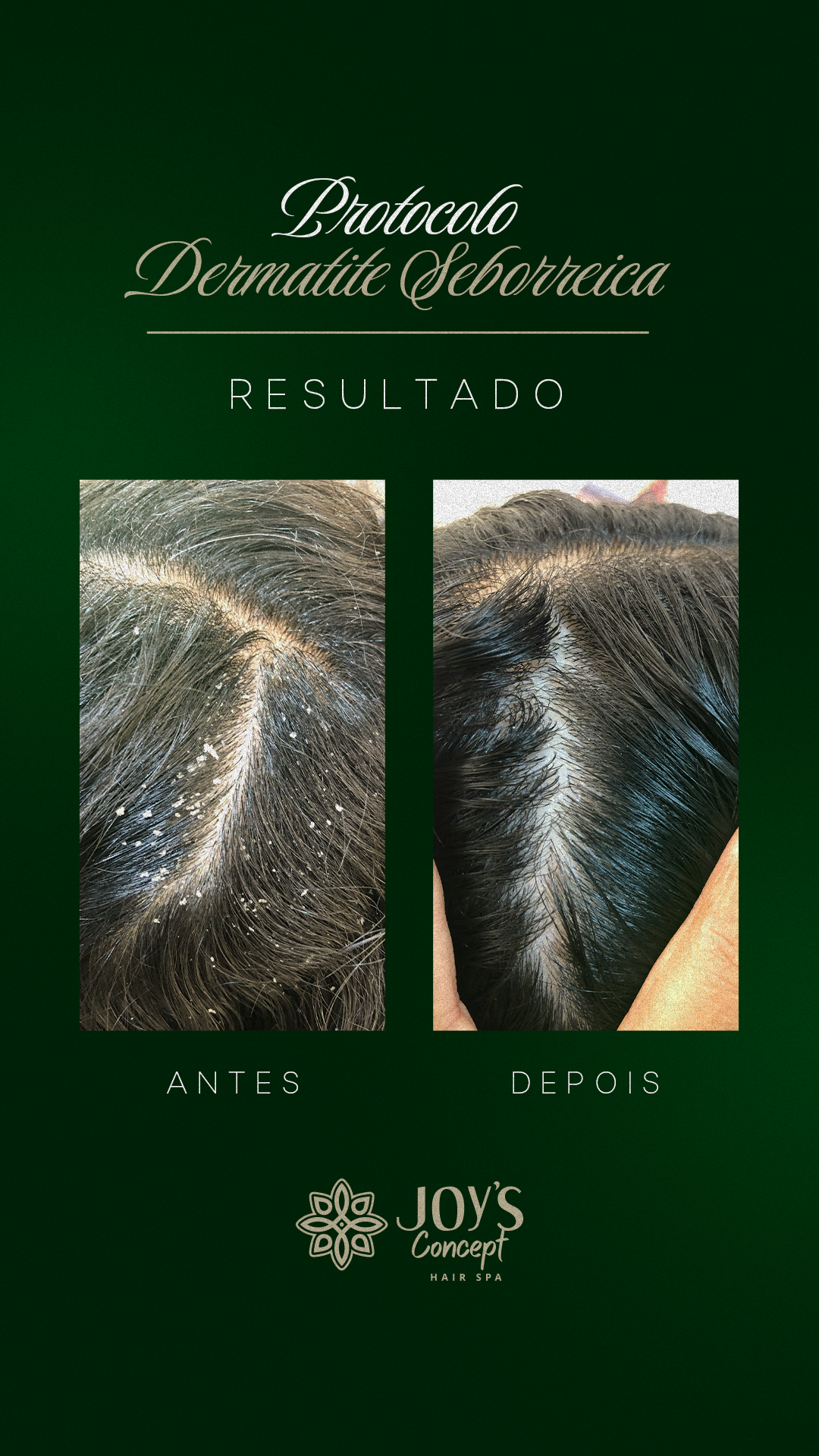 0402---Antes-X-Depois-6-dermatite