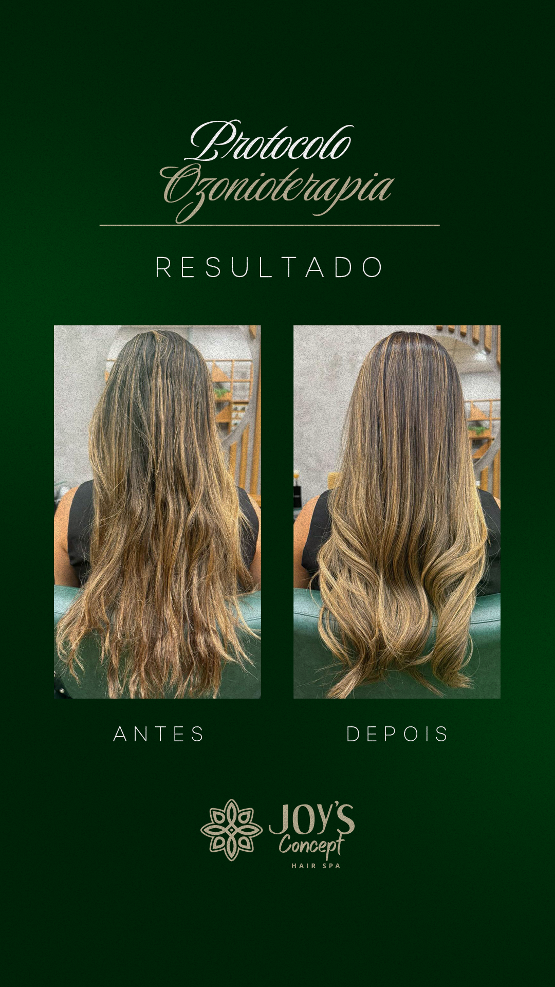 0402---Antes-X-Depois-7-Ozonioterapia